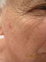 Aging